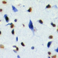 Anti-RING1b Antibody