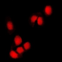 Anti-RING1b Antibody