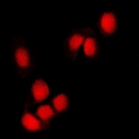 RING1b antibody