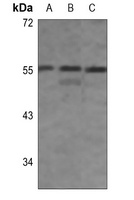 IRF3 (Phospho-S396) Antibody