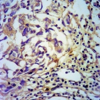 PDGFB antibody