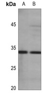 Aquaporin 3 Rabbit Polyclonal Antibody