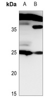 Histone H1 Rabbit Polyclonal Antibody