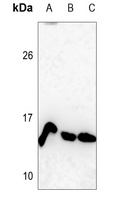 Histone H4 (MonoMethyl-K12) Rabbit Polyclonal Antibody