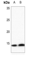 Histone H4 (DiMethyl-K20) Rabbit Polyclonal Antibody