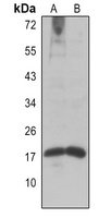 Histone H2A (Acetyl-K9) Rabbit Polyclonal Antibody