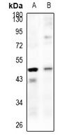 LRG Rabbit Polyclonal Antibody