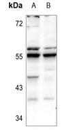 Fetuin B Rabbit Polyclonal Antibody