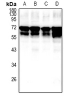 Fetuin A Rabbit Polyclonal Antibody
