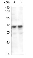 EAAT2 Rabbit Polyclonal Antibody