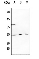 Cathepsin K Antibody