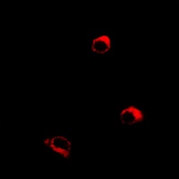 Anti-Orexin Receptor 1 Antibody