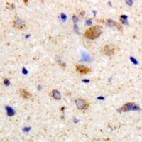 Anti-mGLUR2 Antibody