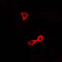 Anti-mGLUR2 Antibody