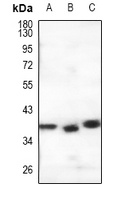 GPR146 Rabbit Polyclonal Antibody