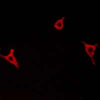 GPR146 antibody