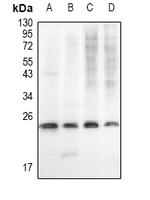 Cathepsin B Antibody