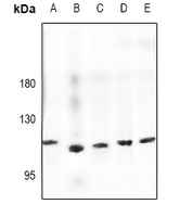Semaphorin 6D Rabbit Polyclonal Antibody