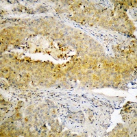 Anti-ECM1 Antibody