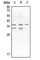 IL-1 beta Rabbit Polyclonal Antibody