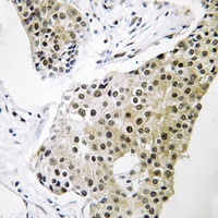TCEAL3/5/6 Antibody