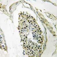 Anti-RFPL4B Antibody
