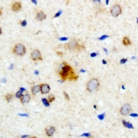 Anti-PXMP4 Antibody