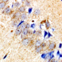 Collagen 4 alpha 4 Antibody