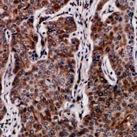 Collagen 5 alpha 2 antibody