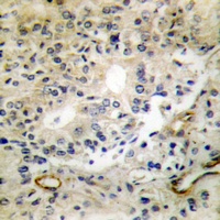 Anti-DLEC1 Antibody