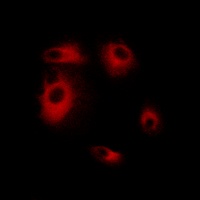 Anti-DLEC1 Antibody