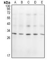 KCHIP1 Antibody