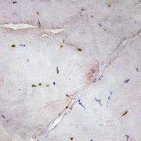 Anti-LATS2 Antibody