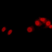 Anti-LATS2 Antibody