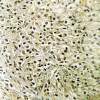 Anti-DLC1 Antibody