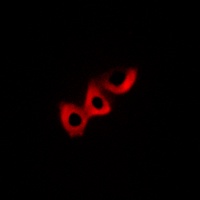 Anti-DLC1 Antibody
