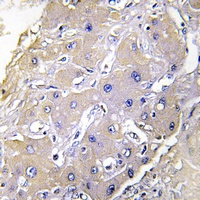 Anti-TNFAIP2 Antibody
