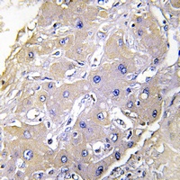 TNFAIP2 antibody