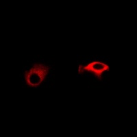 Anti-TNFAIP2 Antibody