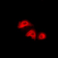Anti-Adenylate Kinase 1 Antibody