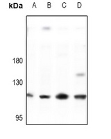 E Cadherin Rabbit Polyclonal Antibody