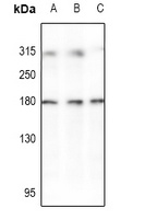 HER2 Rabbit Polyclonal Antibody