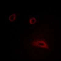 HER2 Rabbit Polyclonal Antibody