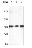 HER2 Rabbit Polyclonal Antibody