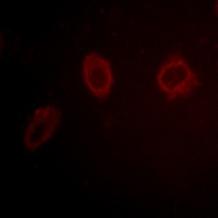 HER2 Rabbit Polyclonal Antibody