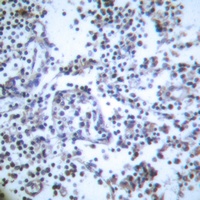 Caspase 3 Antibody