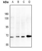CHK2 Antibody