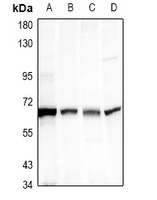 S6K1 Rabbit Polyclonal Antibody