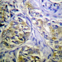 S6K1 Rabbit Polyclonal Antibody