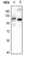 NF-kappaB p105 Rabbit Polyclonal Antibody